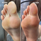 SmoothFeet™ – Gå barfota med stolthet